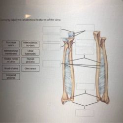 Correctly label the anatomical features of the ulna.