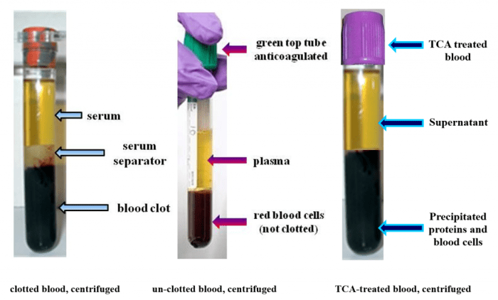 Correctly label the parts of centrifuged blood.