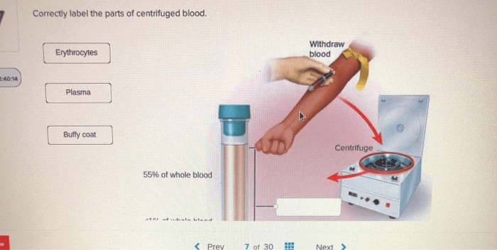 Correctly label the parts of centrifuged blood.